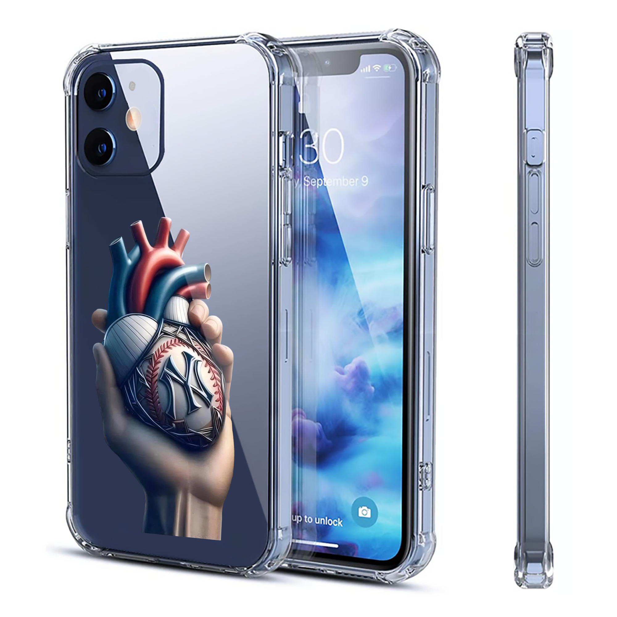 New York Yankees Heart Clear IPhone 12 Case – Soft TPU With UV Print – Enhanced Drop Protection, Precise Fit, Anti-Fingerprint, Customizable Design, Scratch-Resistant, Yellow-Resistant